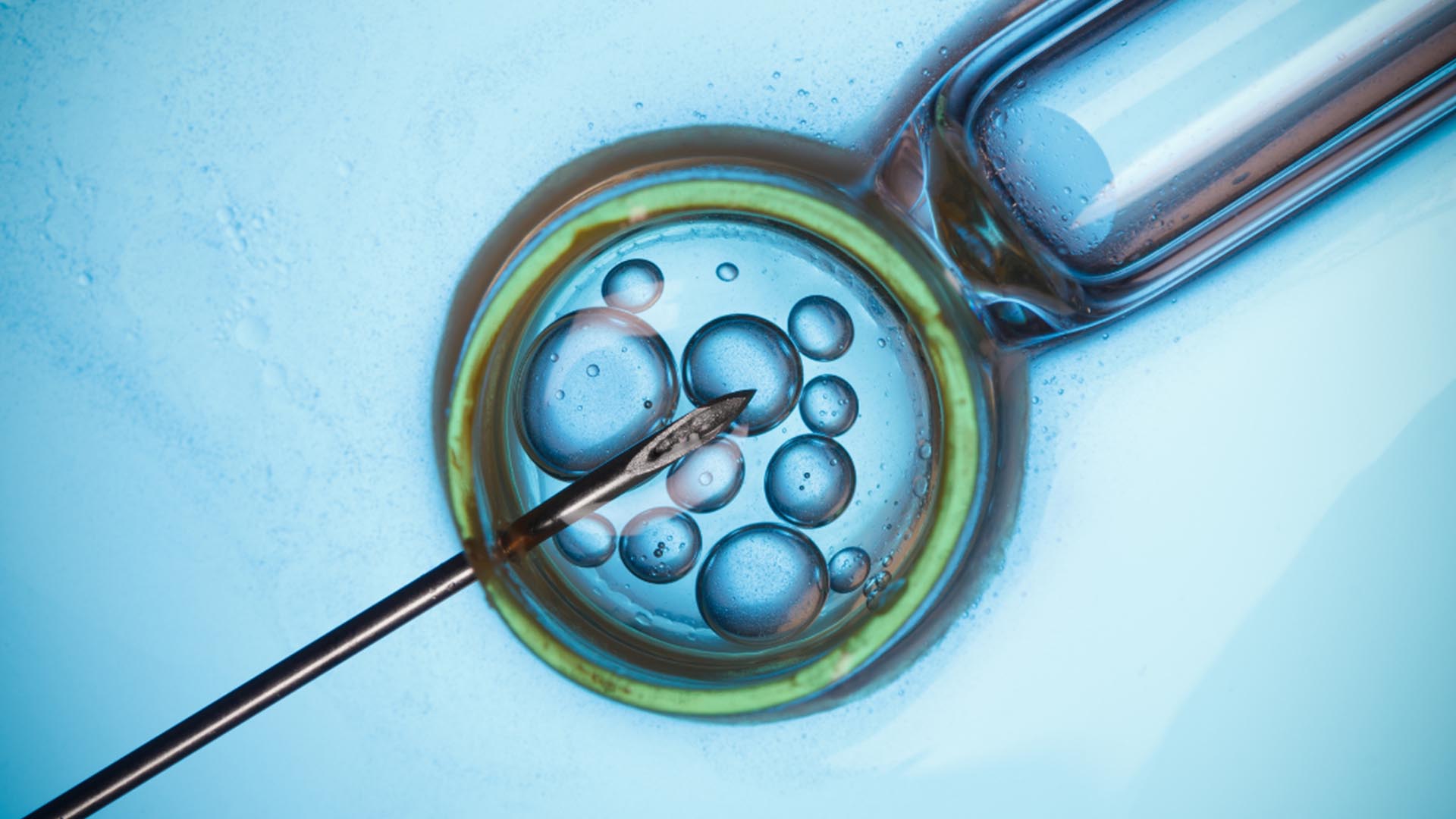 Best ivf doctor in Bangalore 