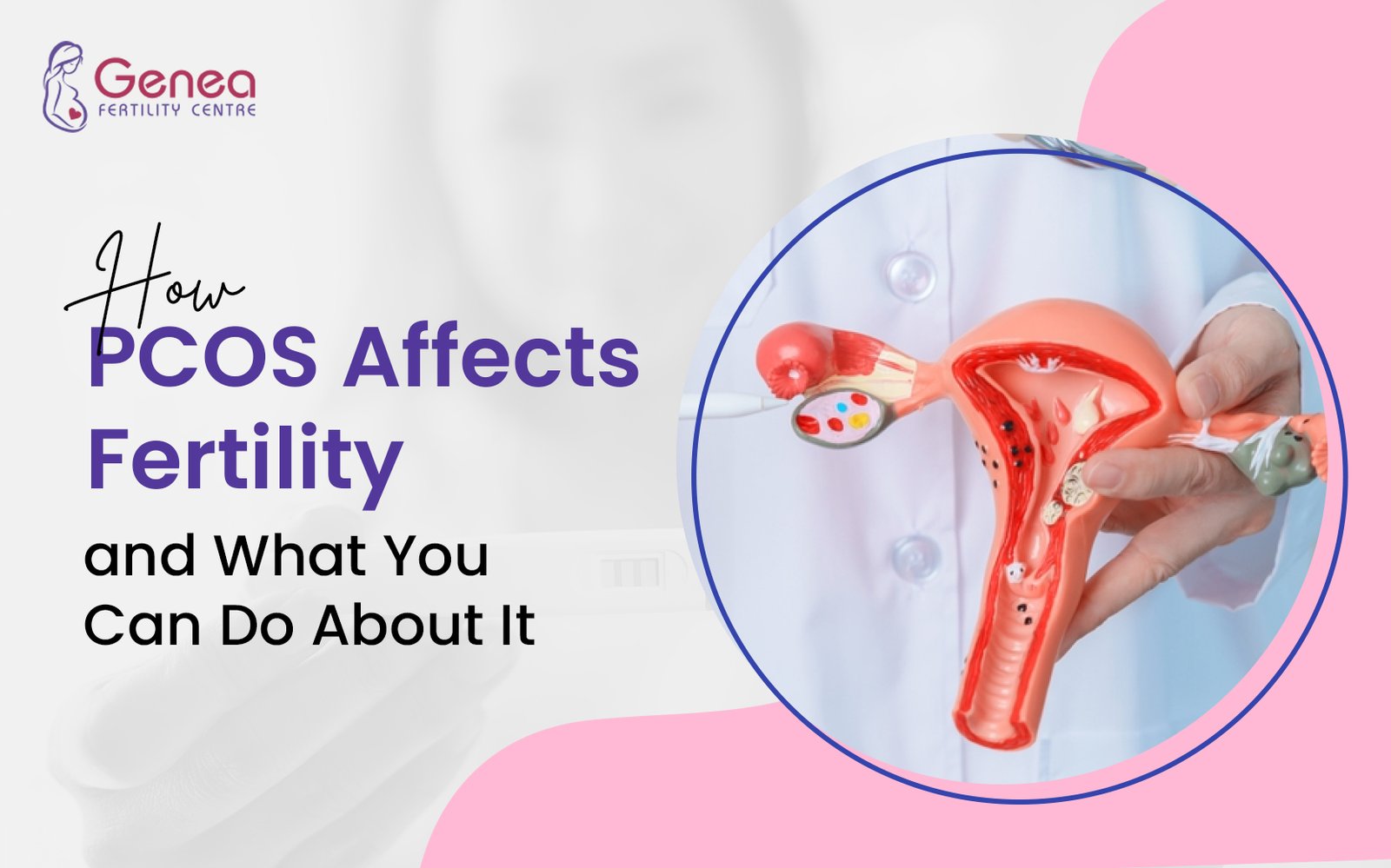 How PCOS Affects Fertility and What You Can Do About It 